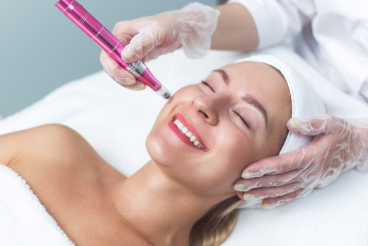 Microneedlinga and what it can do for your skin - LXMI