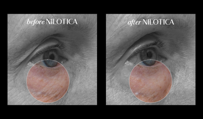 See instant results with LXMI Pure Nilotica Melt