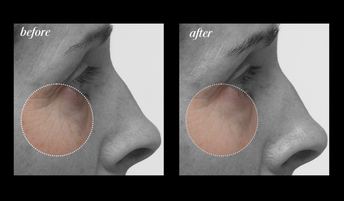 Immediate skin results with LXMI's Nilotica skincare